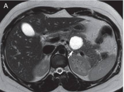 Tommaso Pollini tweet media