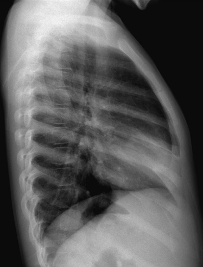 Journal of Brown Hospital Medicine on Twitter "A 5 year old girl