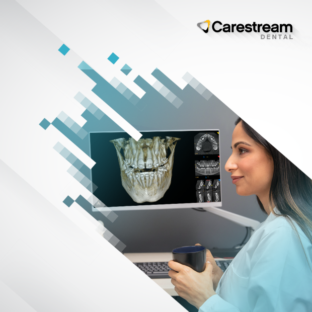 Cone beam computed tomography (CBCT) has infiltrated every dental specialty over the past few years, including orthodontics. Learn how 3D imaging could expand your treatment options. Read the blog here: ow.ly/oziq50NzcKL