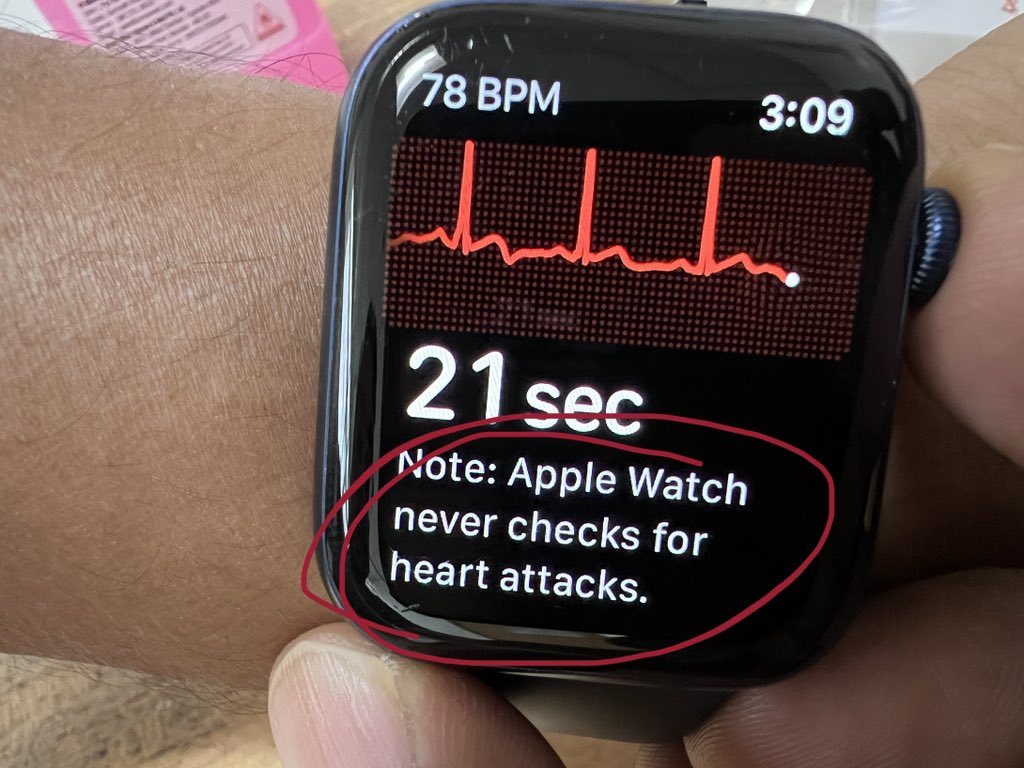 @NishithChandra @tim_cook @Hragy @CMichaelGibson @leftbundle @GreggWStone @AnastasiaSMihai @PCRonline @RameshDaggubati @appleinsider @ShariqShamimMD @nyalborgesmd @radcliffeCARDIO @SGuptaMD @AnkurKalraMD @mswami001 @AnupamPKher @willsuh76 Misleading tweet sir. Apple Watch doesn’t detect MI / heart attacks - even watch clearly mentions this.