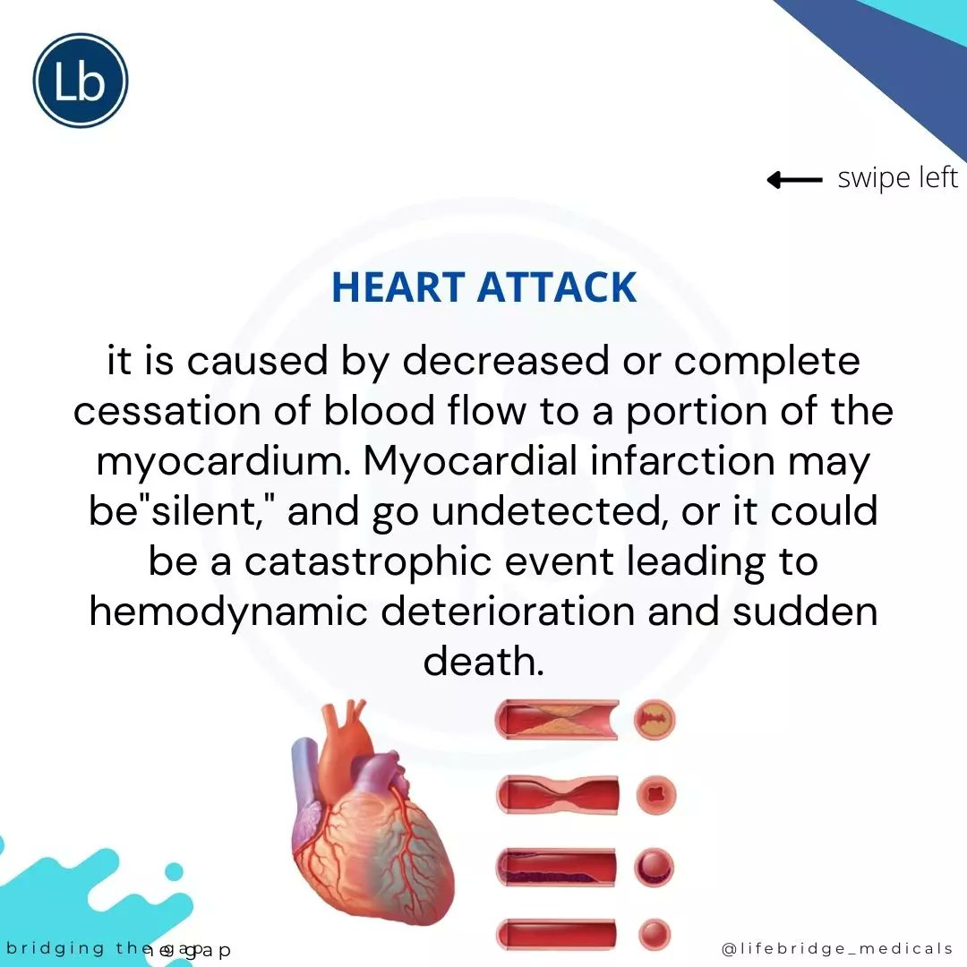 LifebridgeMDC's tweet photo. Regular check up is essential to an healthy heart. Your heart needs oxygen through blood flow.  Reduction or a stop in oxygen supply is dangerous. Let us check you at LifeBridge MDC.

#lifebridge #lifebridgehealth #heartattack #lifebridgemedicals #abuja #abujaevents #health https://t.co/JPnDDe6zW0
