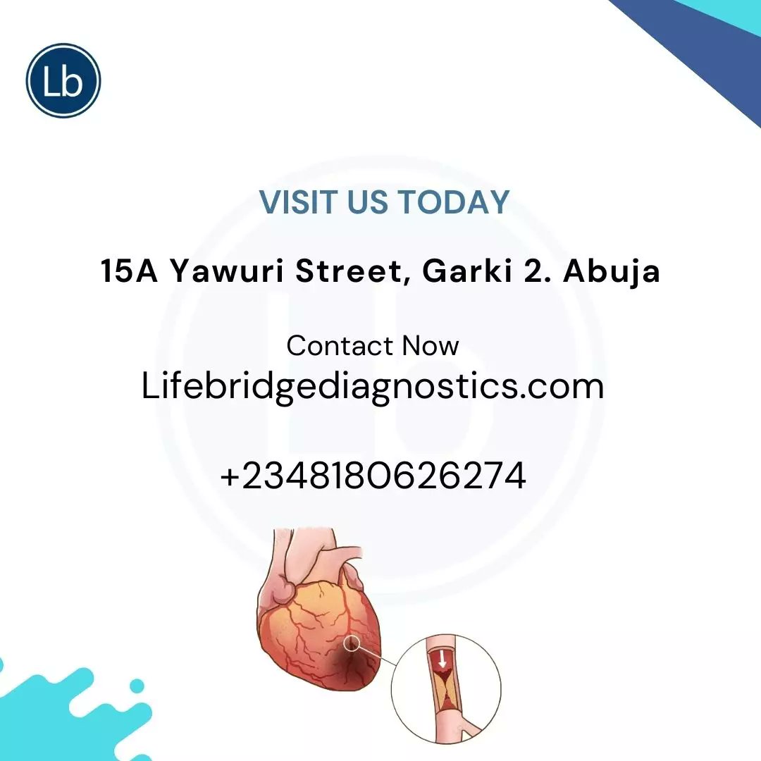 LifebridgeMDC's tweet photo. Regular check up is essential to an healthy heart. Your heart needs oxygen through blood flow.  Reduction or a stop in oxygen supply is dangerous. Let us check you at LifeBridge MDC.

#lifebridge #lifebridgehealth #heartattack #lifebridgemedicals #abuja #abujaevents #health https://t.co/JPnDDe6zW0