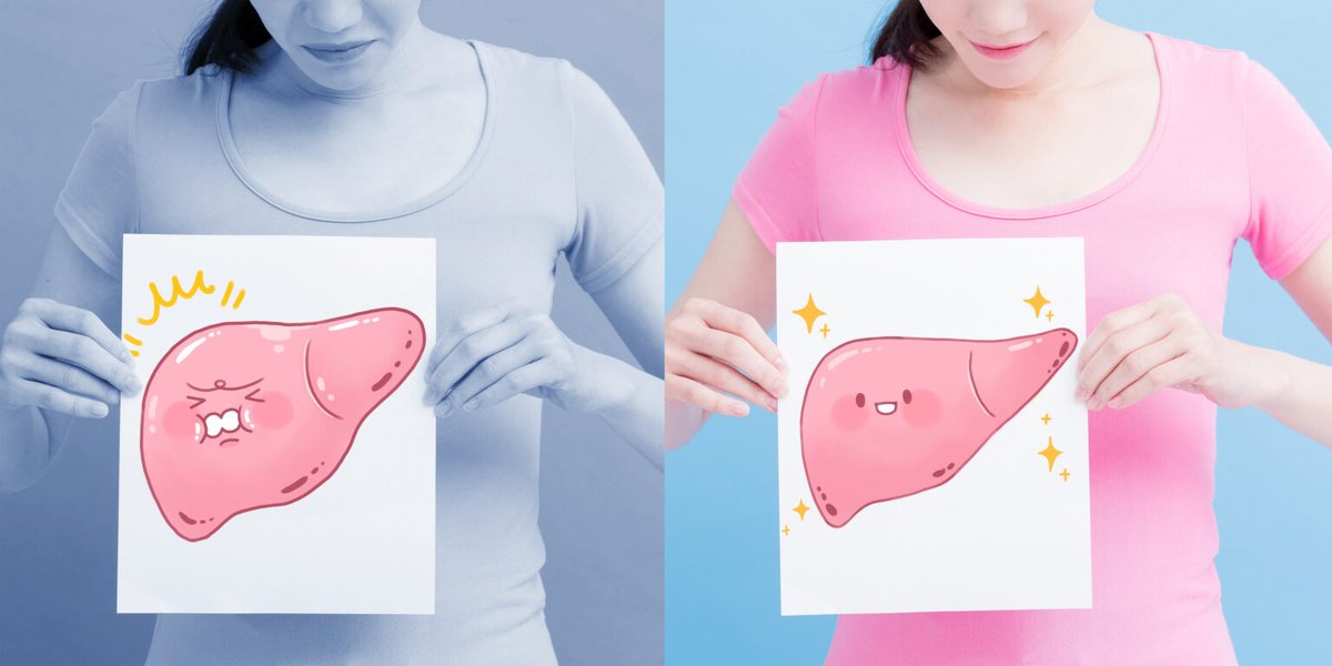 Fettleber: Mit dieser #Ernährung der Leber eine Pause gönnen.<a href="/Gastro_Liga/">Gastro-Liga.de</a> <a href="/ESPENorg/">ESPEN</a> <a href="/ASPEN_nutrition/">ASPEN</a> <a href="/Unispital_USZ/">Unispital_USZ</a> <a href="/TU_Muenchen/">TU München</a> <a href="/VBlasek/">Volker Blasek</a> #Fettleber #Leber #DeutscheLeberstiftung heilpraxisnet.de/naturheilpraxi…