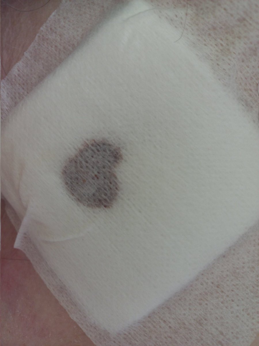 Pansuman yaptığım yara aşık olmuş... Allah yar ve yardımcısı olsun😶