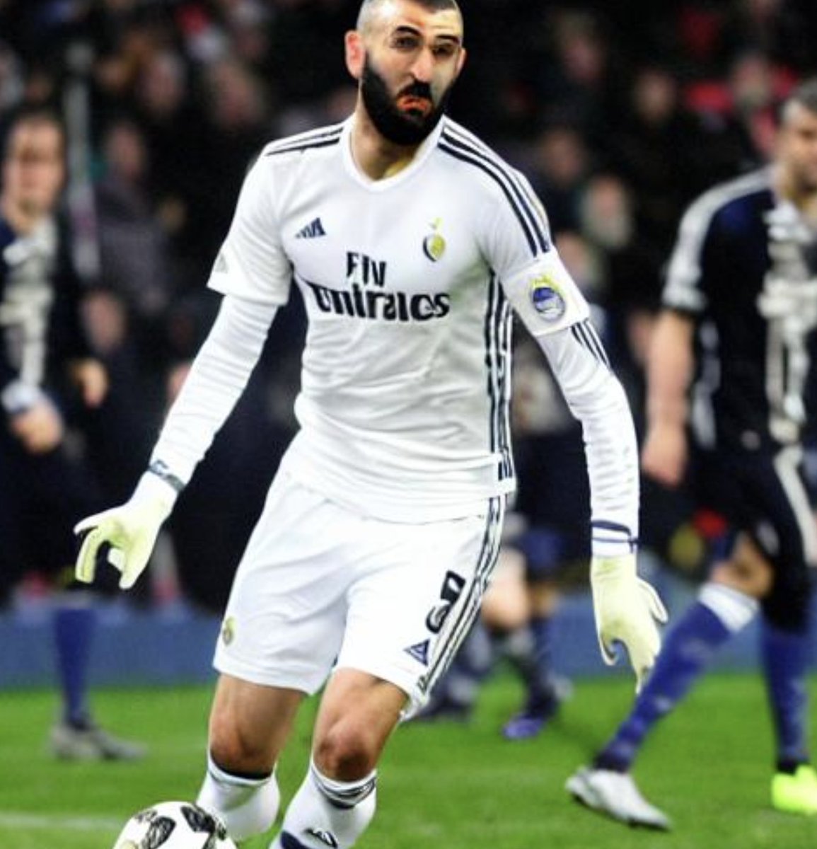 TalkMyFootball's tweet photo. 🤖📸 THREAD 🤖📸

Les pires visuels de joueurs de foot générés par IA. 
Attention, THREAD HISTORIQUE.

🇫🇷 On commence fort avec Karim Benzema. Visiblement fâché sur, probablement car on l'oblige à jouer avec des gants de gardien avec à cause de ses malformations aux mains. 

👇 https://t.co/VGuC8a4fqm