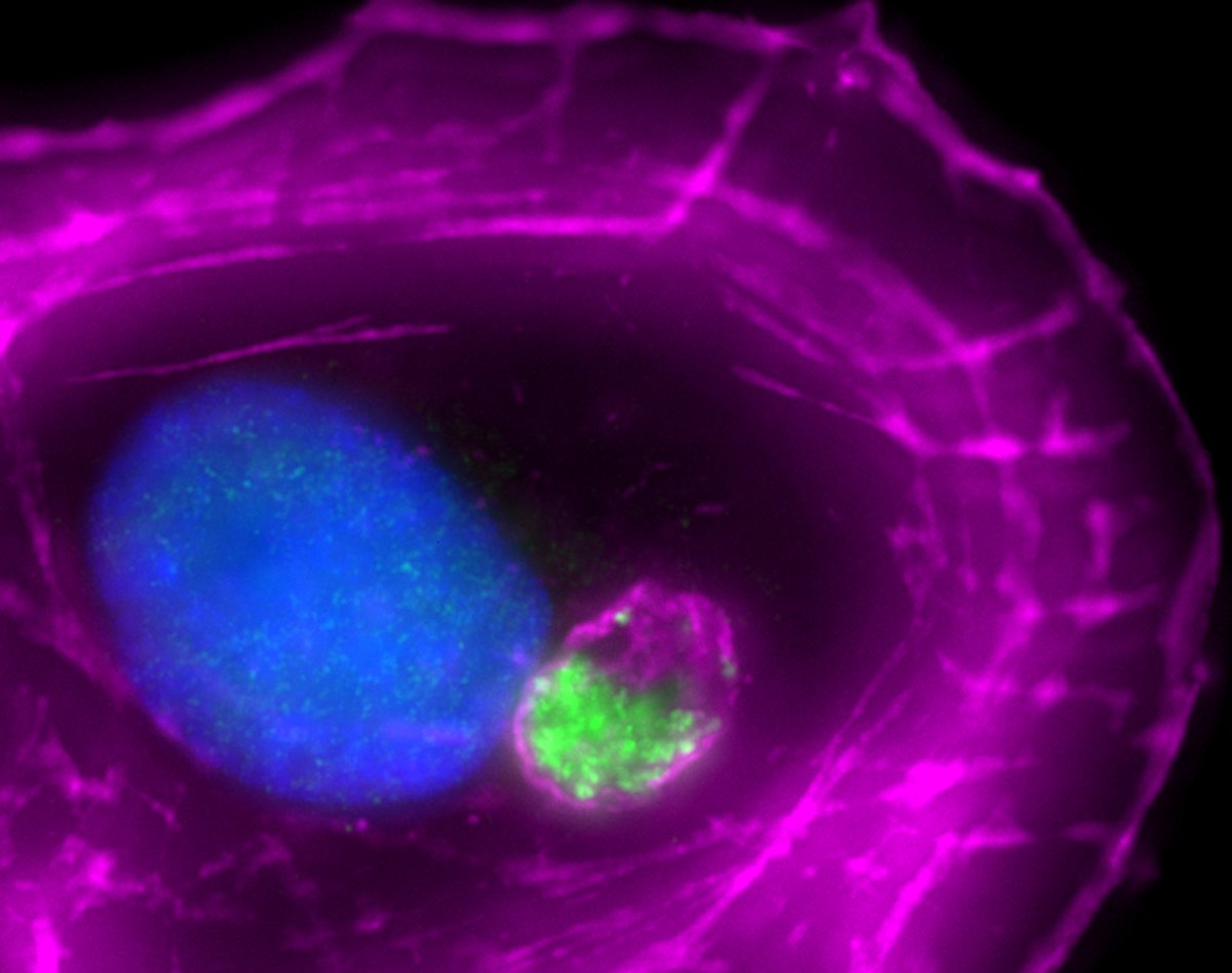 Juxtanuclear F-actin-rich territories coordinate the progression of apoptosome assembly to caspase activation during intrinsic cell death!