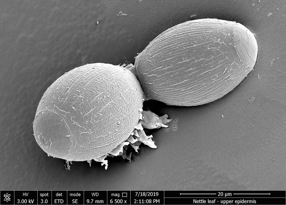 JohnInnesCentre's tweet photo. Our fourth and final image #WorldMicroscopeDay #WhatIsIt is another incidental finding on a nettle leaf image 🍃
But what could these round structures be?
Thanks for playing and don't forget to leave your best guesses under each post! Answers to come tomorrow at noon ⏰ https://t.co/8i0MhCF6z9