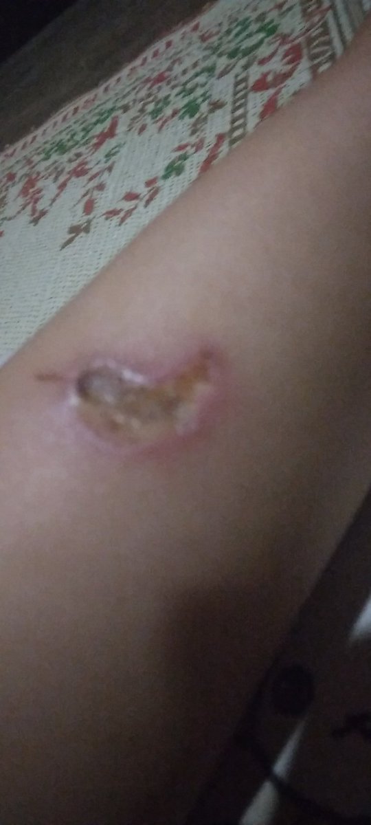 middlecrab's tweet photo. DIKIT LAGI LEBARANNN https://t.co/MkqbdBuhem