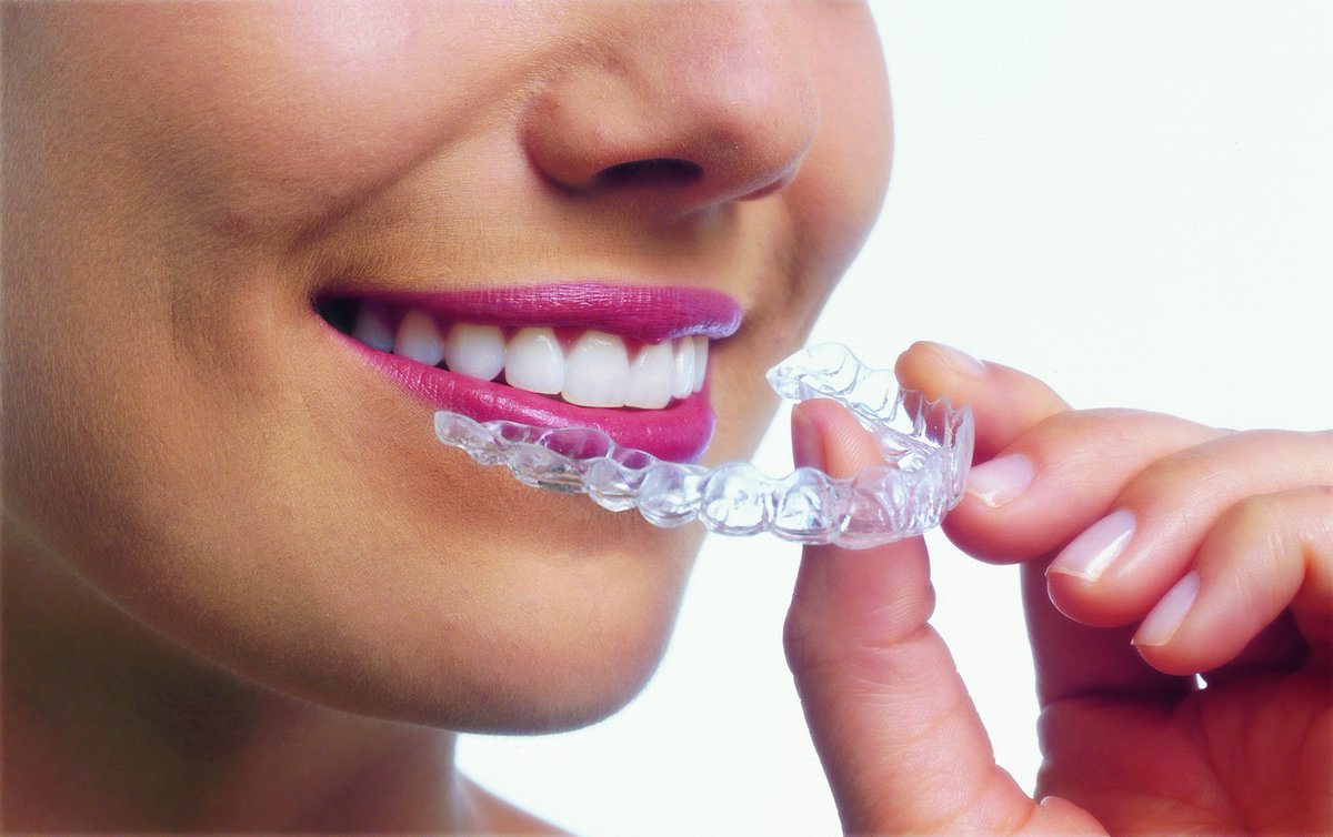 Discover your beautiful new smile with the world’s most advanced clear aligner system. 😊❤️ We’re excited to welcome you to the Des Moines Cosmetic Dentistry Center family! dsmcosmeticdentist.com

#invisalign #invisalignsmile