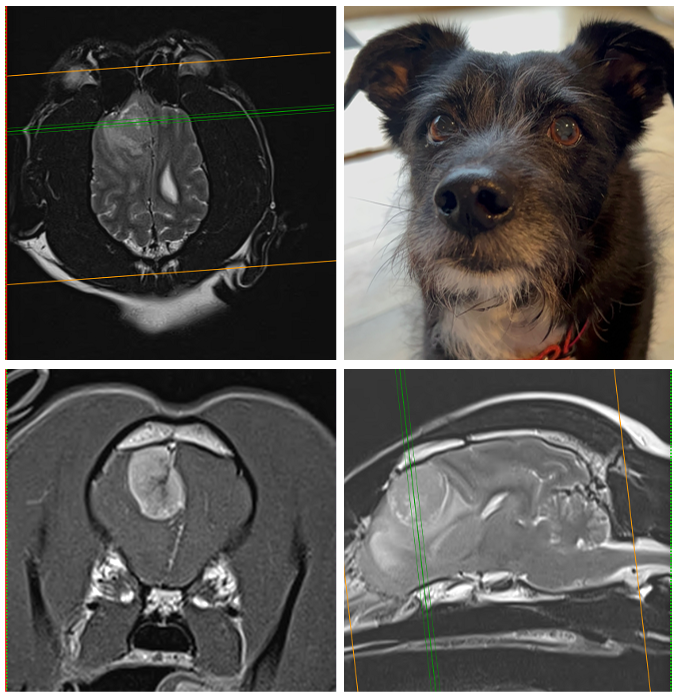 CVSGroupPlc's tweet photo. Thanks @ThomasMignan @dovecotevethosp whose craniectomy & debulking surgery removed a tumour from Bob who’d experienced epileptic seizures & was diagnosed with meningioma brain tumour. He's now doing really well & has had no further complications https://t.co/dFb3zsQINO #cvsgroup https://t.co/5b73tECbzM