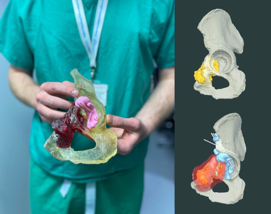 Insight Surgery tweet media