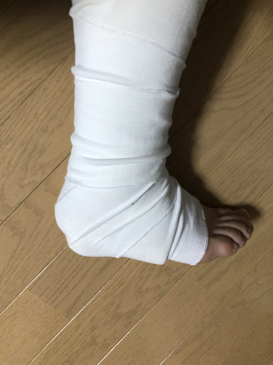 angokoro's tweet photo. 捻挫でした
シーネ&amp;包帯
ギプスが良かったな https://t.co/PAs60dAl4F