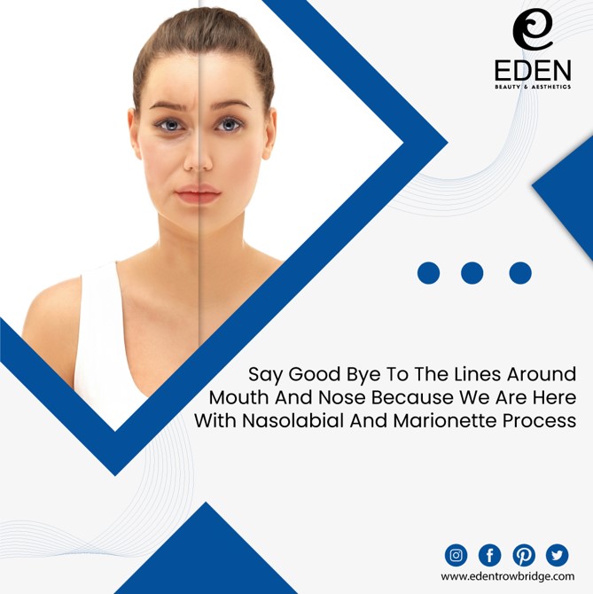 edentrowbridge's tweet photo. Do you feel self-conscious about lines around your mouth and nose? Our Nasolabial and Marionette process can help! 

#edentrowbridge #beautyandaesthetics #beautyandbeyond #premierdestination #booknow #luxurylocation #confidenceboosting #beautytratments #skincare #bodyconfidence https://t.co/ITyjhB4MC6