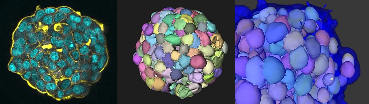 BeghinTeam's tweet photo. Innovative 3D segmentation of #organoids + datamining software = OrganoProfiler(?)
 @MBIsg @QuantaCell_SAS https://t.co/5vZ4vOwo5j