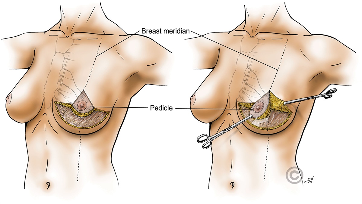 Plastic and Reconstructive Surgery tweet media