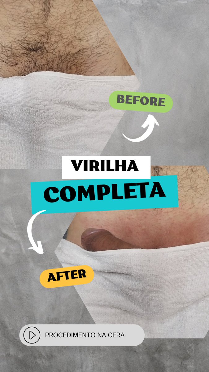 Virilha completa na cera !!!  Um antes e depois do procedimento com cliente bem satisfeito.