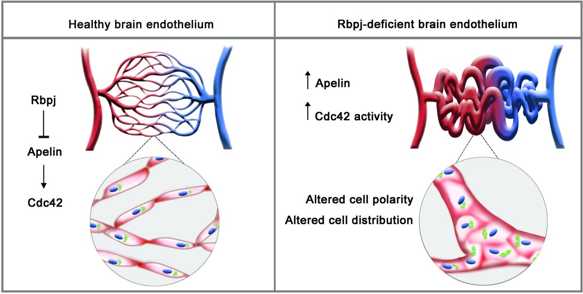 Stroke AHA/ASA (@strokeaha_asa) on Twitter photo #OriginalResearch: In this study using in vivo mouse model of Rbpj-mediated brain AVM, pharmacologically inhibiting Apelin/Apj signaling may prevent bpj mediated brain AVM development. #stroke #AHAJournals ahajournals.org/doi/10.1161/ST… <a href="/adhicary/">Subhodip Adhicary</a> <a href="/Fanelligirl/">Kayleigh Fanelli</a> #OriginalResearch: In this study using in vivo mouse model of Rbpj-mediated brain AVM, pharmacologically inhibiting Apelin/Apj signaling may prevent bpj mediated brain AVM development. #stroke #AHAJournals ahajournals.org/doi/10.1161/ST… <a href="/adhicary/">Subhodip Adhicary</a> <a href="/Fanelligirl/">Kayleigh Fanelli</a>