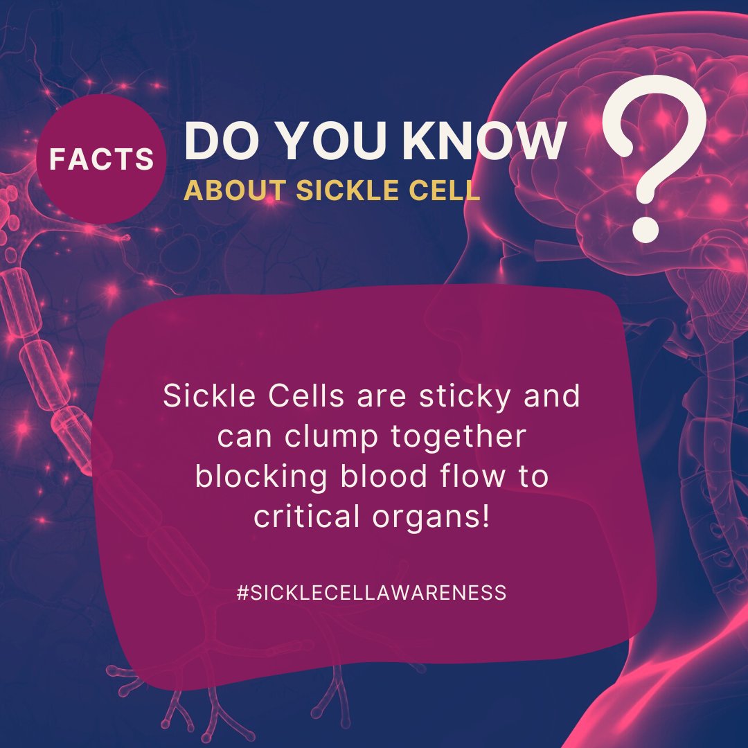 SCAFCincy's tweet photo. Sickle Cell impacts the entire body.  To learn more about Sickle Cell Disease please visit https://t.co/rmpZ4gvGI7 today!

#SickleCellAwareness #SickleCells #BloodDisorder #RareDisease #RareBloodDisorder #SickleCellDisease #SickleCellTrait #SickleCellWarriors #ScafCincy https://t.co/aMBIfLFyZS