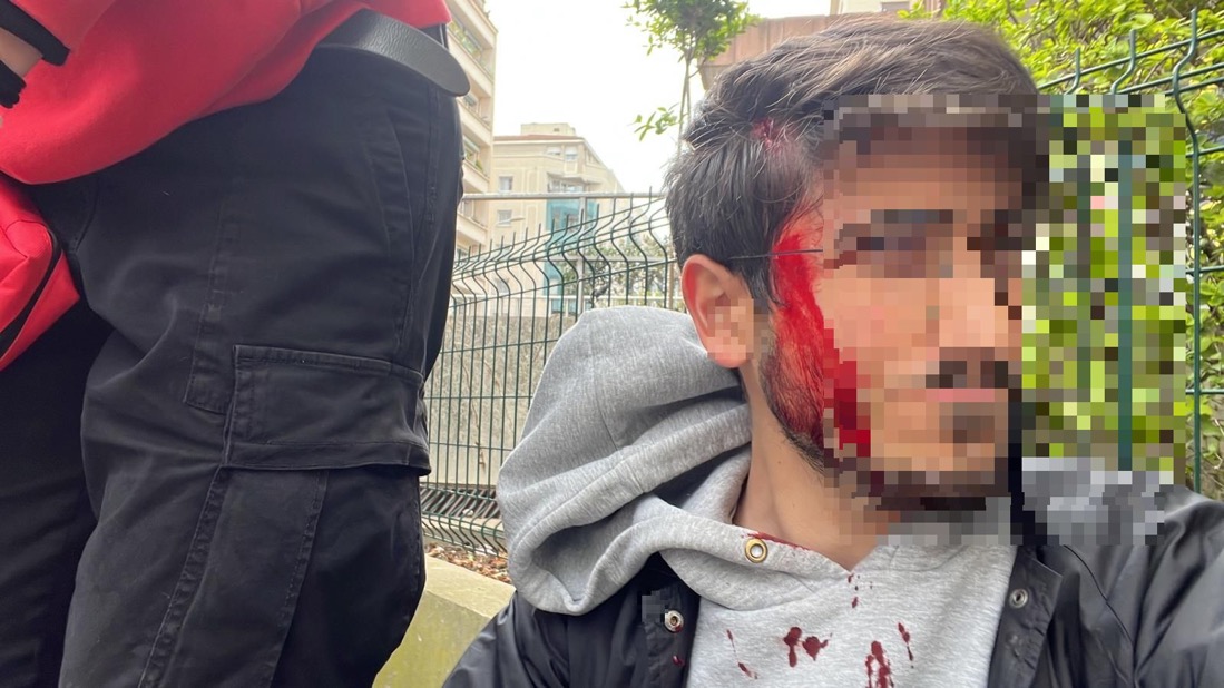 Mediavenir's tweet photo. 🇫🇷 FLASH - Un journaliste d’Actu #Lyon a été matraqué à la tête après être tombé au sol pendant une charge policière. Il a été évacué vers un hôpital. (via @actufr_lyon) #greve13avril #reformedesretraites https://t.co/Z0hWwK4bse