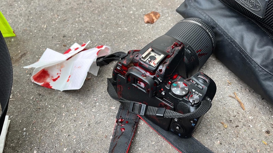 Mediavenir's tweet photo. 🇫🇷 FLASH - Un journaliste d’Actu #Lyon a été matraqué à la tête après être tombé au sol pendant une charge policière. Il a été évacué vers un hôpital. (via @actufr_lyon) #greve13avril #reformedesretraites https://t.co/Z0hWwK4bse