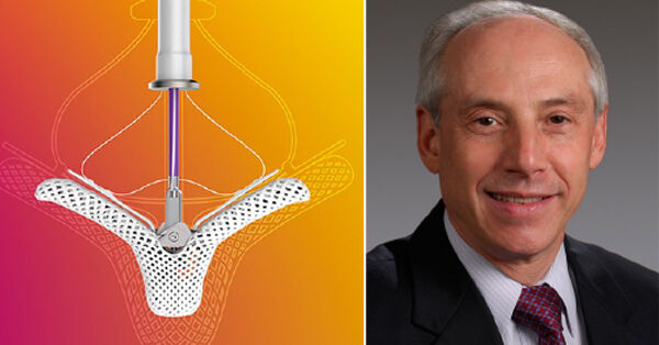 Adam Pick On Twitter Mitral Valve Disease Innovations How Are New 