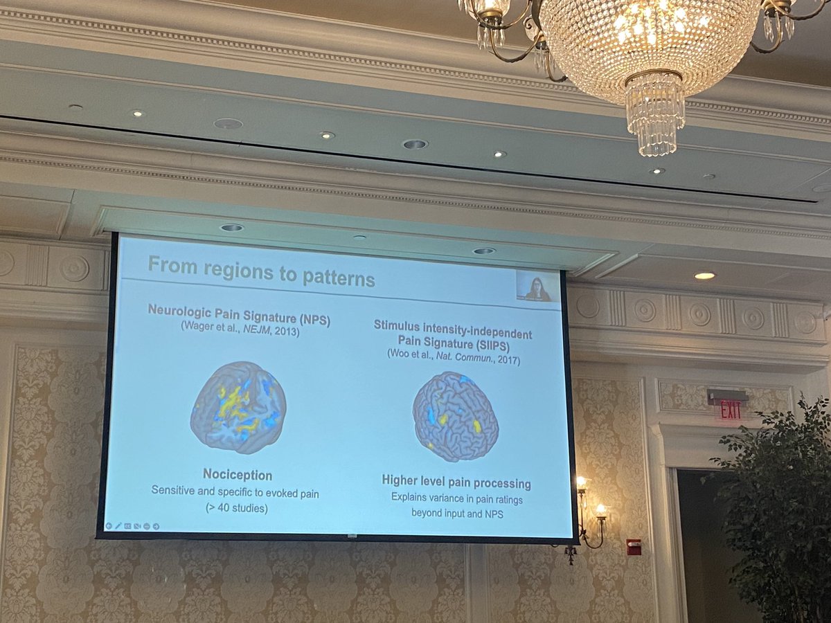 a2cps_pain's tweet image. Have we mentioned how deep and broad our Consortium’s expertise is? Here Rotem Botvinik-Nezer @rotembot presents her work done in the lab of #A2CPS investigator @torwager on the brain circuitry of #placebo #USASP