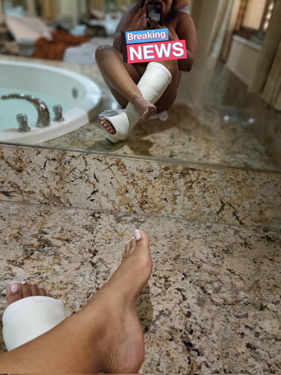 feetofqueen's tweet photo. Aquí sólo darán Like,RT y Comentarán los Casters de mi Twitter💋
.
.
.
#castfetish #castedgirl #slwc #SLC #ebonyfeetincast #enyesada #yeso #gesso #engessada #medicalfetish #nurseinacast #pieenyesado #enfermeraenyesada https://t.co/thIKmuZvQ0