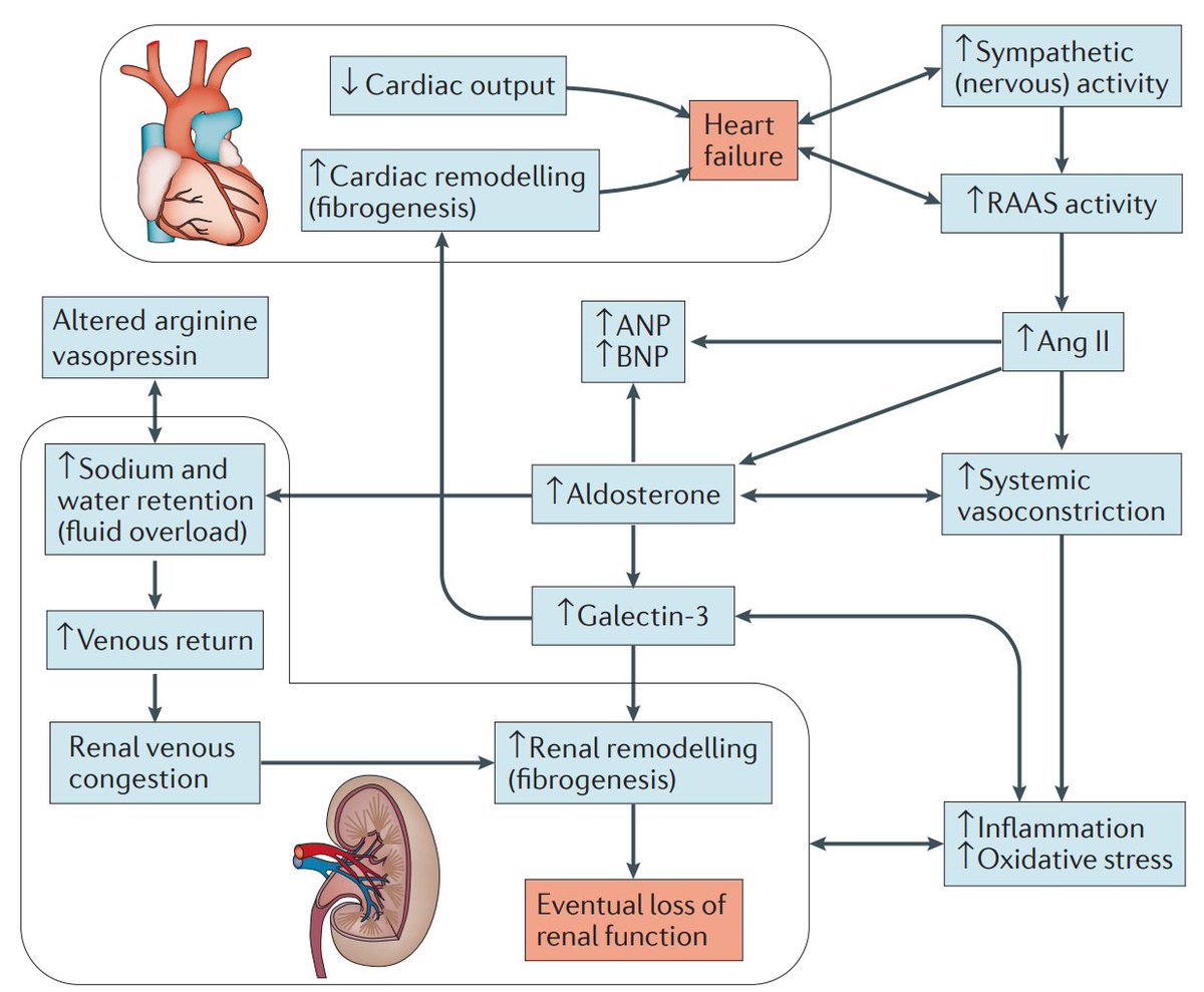 edgarvlermamd's tweet photo. Cardiorenal syndrome: Definitions, Hemodynamic mechanisms, Neurohormonal mechanisms
#NKFClinicals #Nephpearls 

👉 https://t.co/wHlKnYCua8 https://t.co/GQepSddlPK