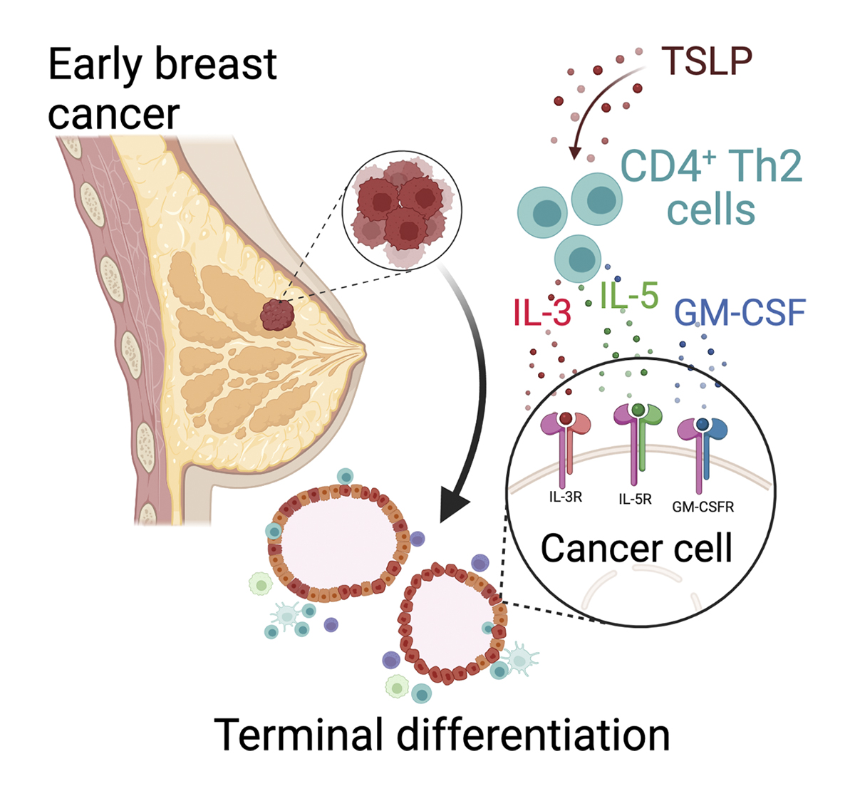 JExpMed's tweet photo. Boieri, @CaImmunoprevent et al. show that CD4+ T helper 2 cells directly block #breastcancer development by forcing the cancer cells to terminally differentiate. https://t.co/ykzBgS4ZsR

From our #Cancer Collection: https://t.co/SKFIre0wNt 
#AACR23 https://t.co/OyBW6RYHL4