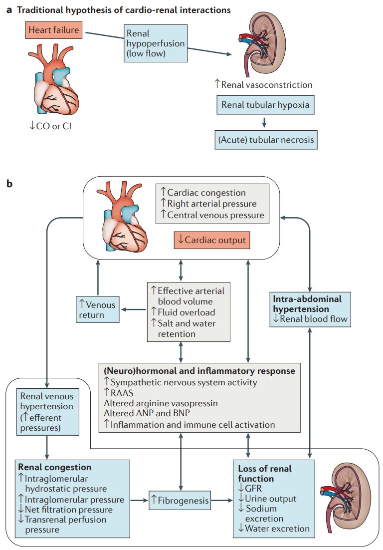 edgarvlermamd's tweet photo. Cardiorenal syndrome: Definitions, Hemodynamic mechanisms, Neurohormonal mechanisms
#NKFClinicals #Nephpearls 

👉 https://t.co/wHlKnYCua8 https://t.co/GQepSddlPK