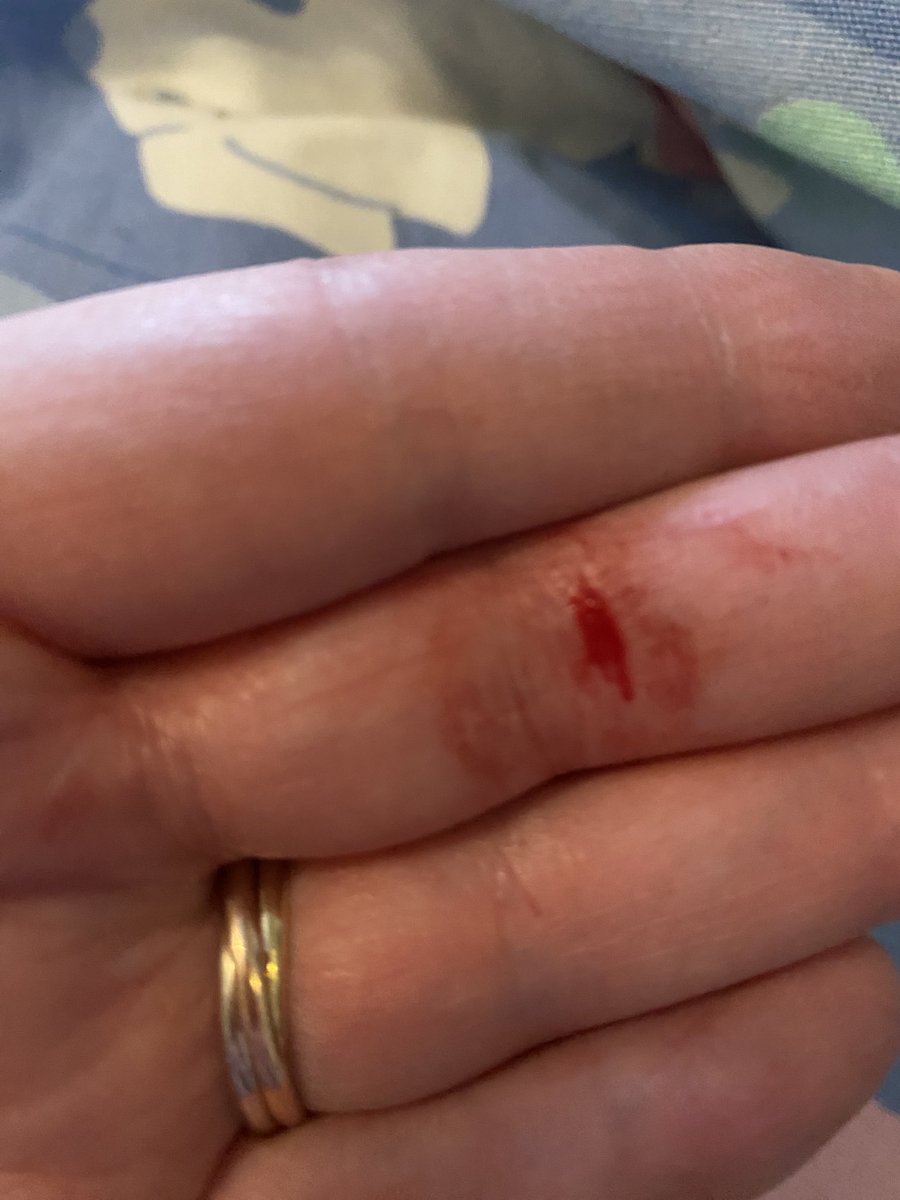 jniemi37's tweet photo. Hitto on teräviä,kissa ruoka purkit,kansi samanlainen kuin viilissä😯ja haava😟
#Samperi https://t.co/gACq02OtnB