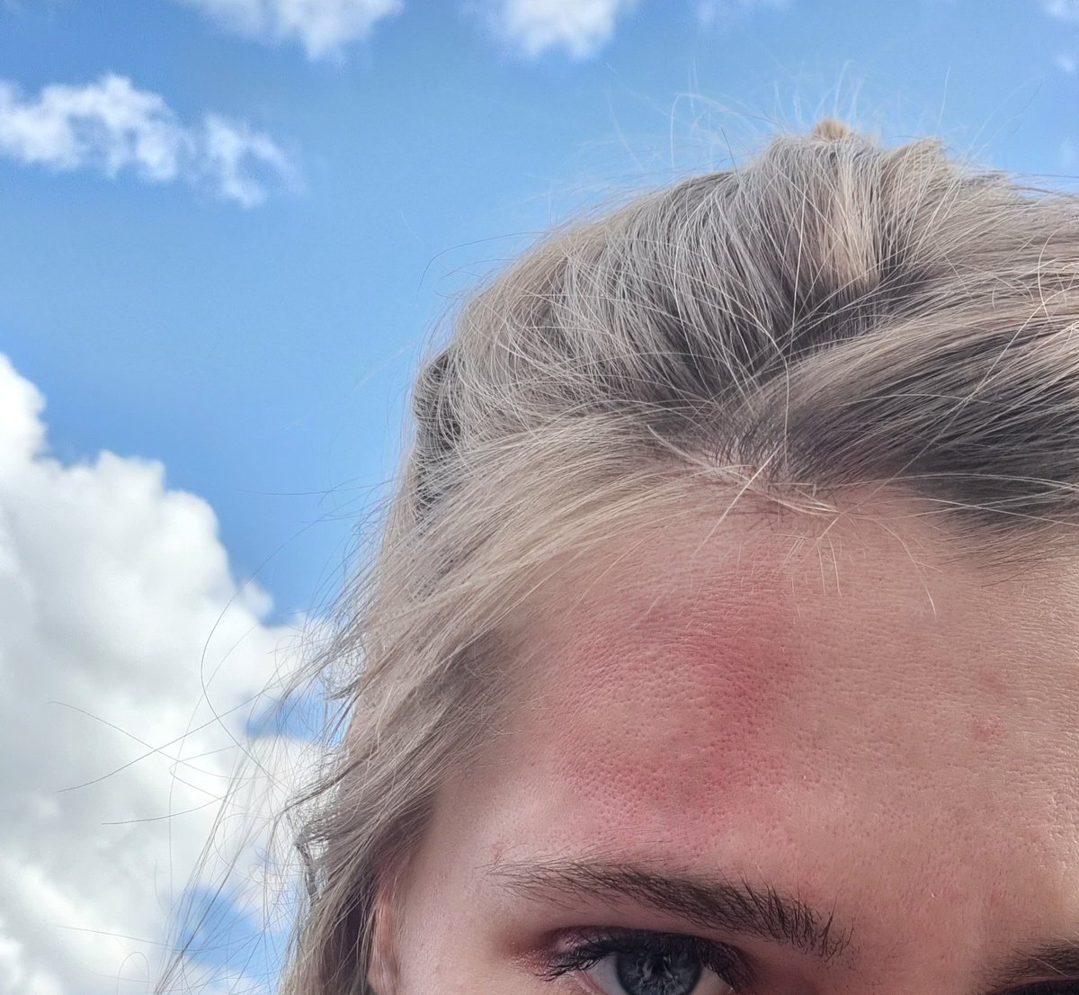 MarionBeauvalet's tweet photo. J'ai reçu un projectile noir à Bastille sur le front, proche de mon oeil. C'est arrivé fort en cloche, alors que nous étions à distance. Ces techniques de "maintien de l'ordre" sont dangereuses. https://t.co/canlBLrW9c