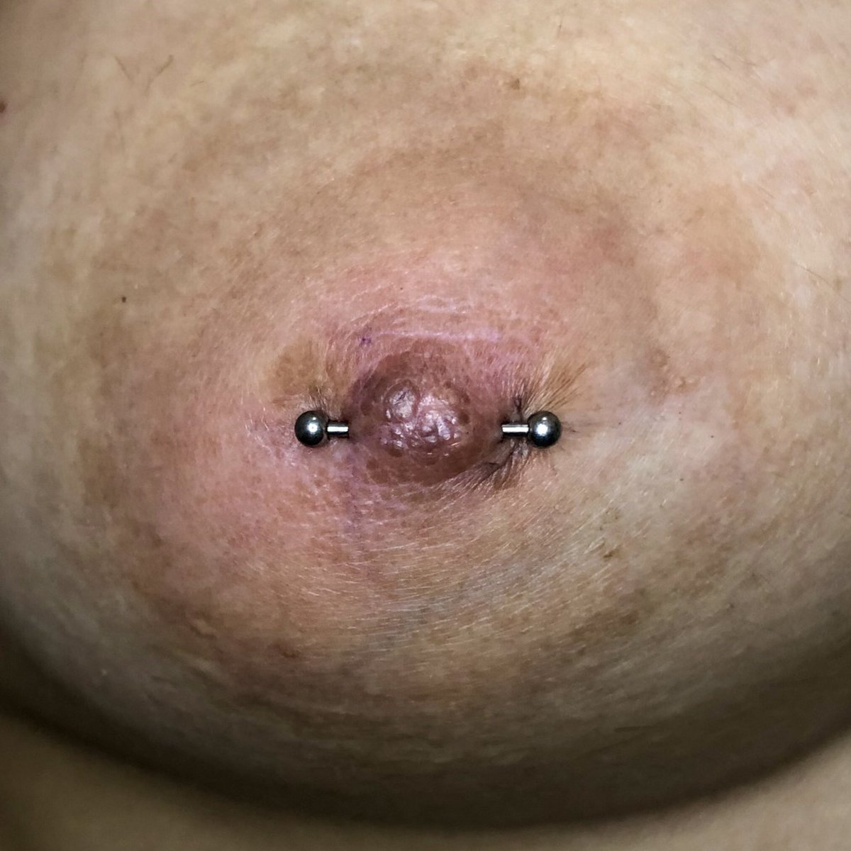 joycaiuby's tweet photo. Nipple Piercing com joia Barbell em Titânio✨
A cliente tinha uma perfuração antiga já cicatrizada e refizemos, na foto da pra ver as marquinhas antigas na auréola.
#nipplepiercing #safepiercing #titaniumpiercing #piercingmamilo #piercingtitanio https://t.co/dVt9Bdhi8N