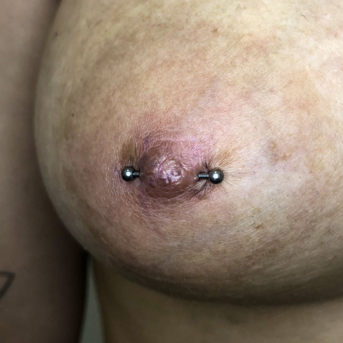 joycaiuby's tweet photo. Nipple Piercing com joia Barbell em Titânio✨
A cliente tinha uma perfuração antiga já cicatrizada e refizemos, na foto da pra ver as marquinhas antigas na auréola.
#nipplepiercing #safepiercing #titaniumpiercing #piercingmamilo #piercingtitanio https://t.co/dVt9Bdhi8N