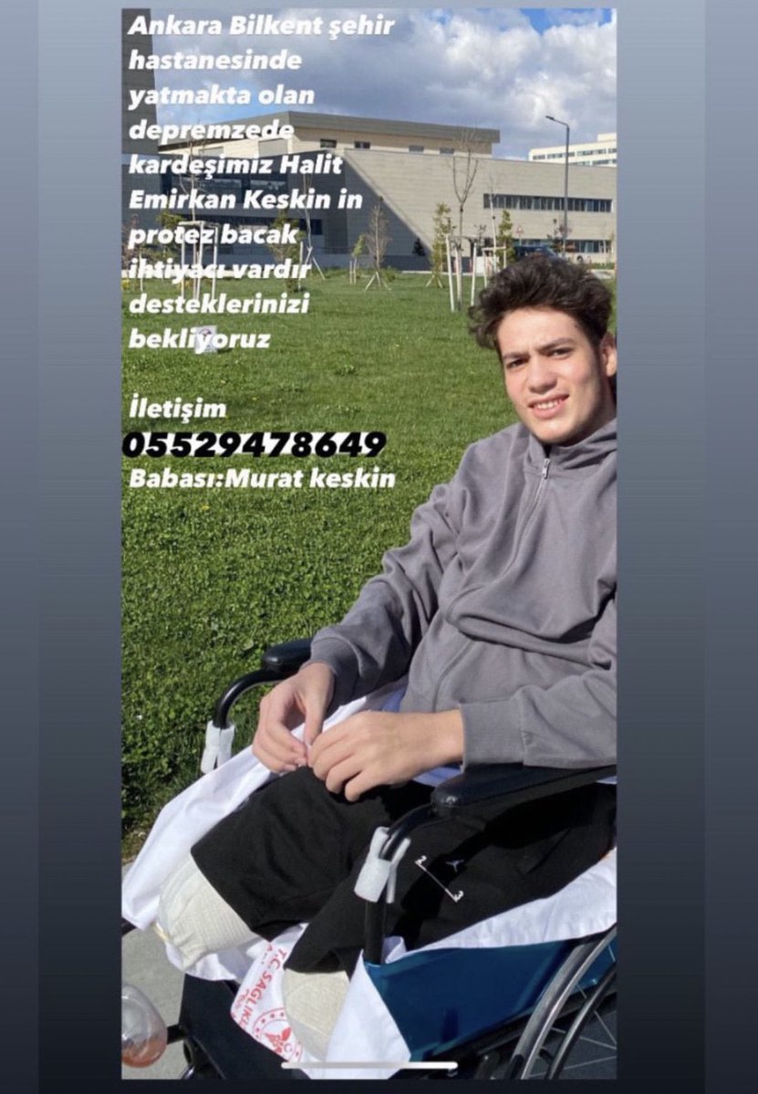 Bu yakışıklı benim kuzenim, protez bacak ihtiyacı var. yayılmasına yardımcı olabilirseniz çok sevinirim