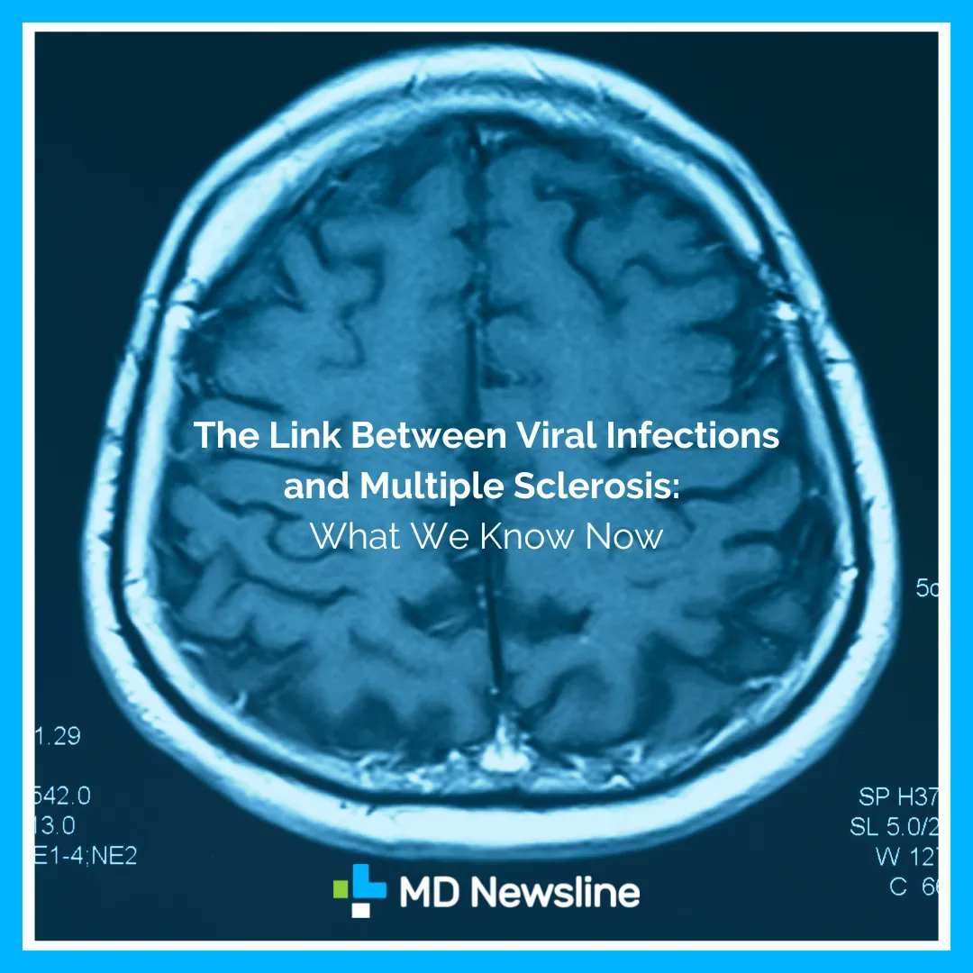 Researchers have discovered that viral infections such as Epstein-Barr virus, human herpes virus 6, human endogenous retrovirus, cytomegalovirus, and varicella zoster virus may be linked to the onset of #MultipleSclerosis 

buff.ly/3KjP11M 

#viralinfections  #MDNewsline