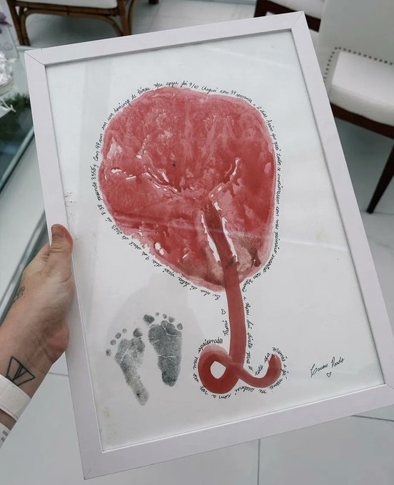 ALFINETEI's tweet image. 🚨 EITA! Viih Tube e Eliezer estão sendo criticados por enquadrar a placenta da filha.