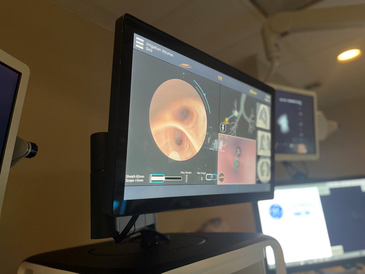 NM_Lung's tweet photo. Benjamin Seides, MD (@bseidesMD), regional director of Interventional Pulmonology at Northwestern Medicine Central DuPage Hospital just completed his 300th robotic bronchoscopy procedure using the Monarch Platform. https://t.co/SjWS5AsKE7