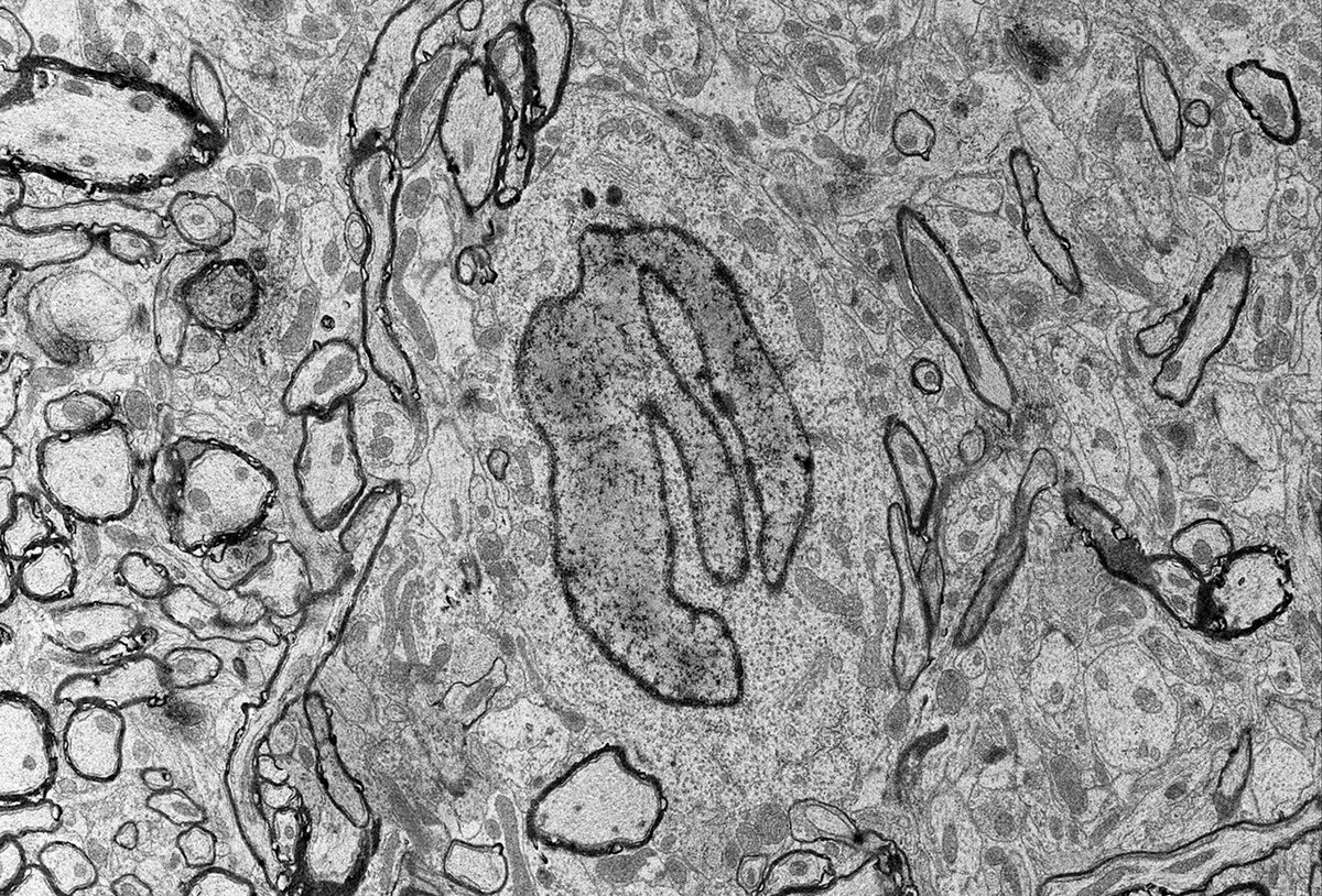 JEOLUSA's tweet image. Image of the Day ~  &quot;This energy drink is affecting my neurons!&quot; The “M” in the middle of the neuron looks a little like the energy drink logo. Lita Duraine, Baylor College of Medicine; JEOL 1400 Plus TEM.  #ImageContest #TransmissionElectronMicroscope #Neuron #M