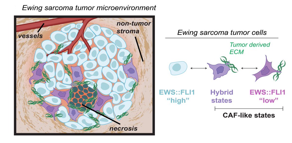 Emma Wrenn (@wrenn_emma) on Twitter photo Check out our preprint on Ewing sarcoma tumor cells that secrete tumorigenic ECM like CAFs! biorxiv.org/content/10.110… @Lawlorlab <a href="/ApfelbaumApril/">April Apfelbaum, PhD</a> Check out our preprint on Ewing sarcoma tumor cells that secrete tumorigenic ECM like CAFs! biorxiv.org/content/10.110… @Lawlorlab <a href="/ApfelbaumApril/">April Apfelbaum, PhD</a>