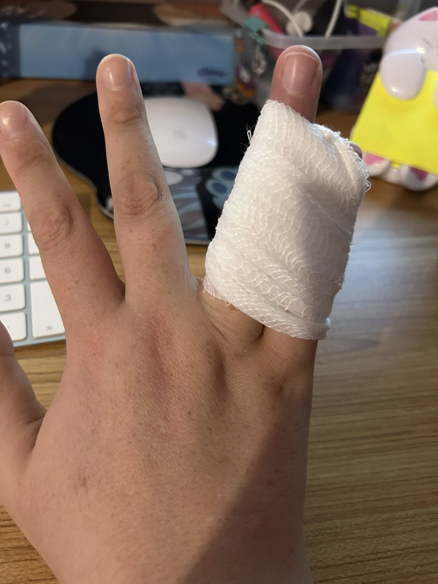 julieannemander's tweet image. Well this is slightly inconvenient, who knew a broken pinkie finger could be such a pain 🙄 Never broken anything ever before, typical me it had to be something stupid 🫣 #brokenbones #pinkiefinger #justmyluck