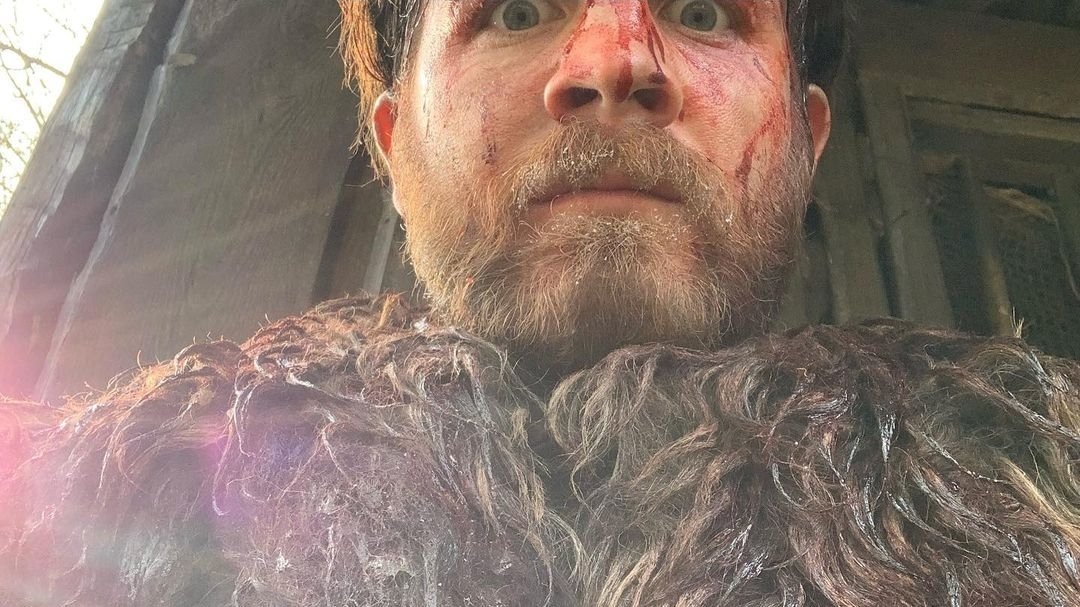 Harry Anton Official Fan Group ❤. (@harryantonoffi1) on Twitter photo Harry aka Bresal sprout 😂🤣 just shared these on Insta from his time on TLK! Sweet memories for us all ❤⚔🛡 photo credit <a href="/NorthcoteJames/">James Northcote</a> <a href="/TheLastKingdom/">The Last Kingdom</a> <a href="/Thelastkingdom5/">thelastkingdomfansite international</a> <a href="/Deborah73407201/">Deborah Davis</a> <a href="/trnguyen1971/">Trina Nguyen</a> <a href="/rehana10/">Rehana Mohammed</a> <a href="/chattycat14/">CHATTYCAT14</a> #harryantonofficialfangroup ❤ Harry aka Bresal sprout 😂🤣 just shared these on Insta from his time on TLK! Sweet memories for us all ❤⚔🛡 photo credit <a href="/NorthcoteJames/">James Northcote</a> <a href="/TheLastKingdom/">The Last Kingdom</a> <a href="/Thelastkingdom5/">thelastkingdomfansite international</a> <a href="/Deborah73407201/">Deborah Davis</a> <a href="/trnguyen1971/">Trina Nguyen</a> <a href="/rehana10/">Rehana Mohammed</a> <a href="/chattycat14/">CHATTYCAT14</a> #harryantonofficialfangroup ❤