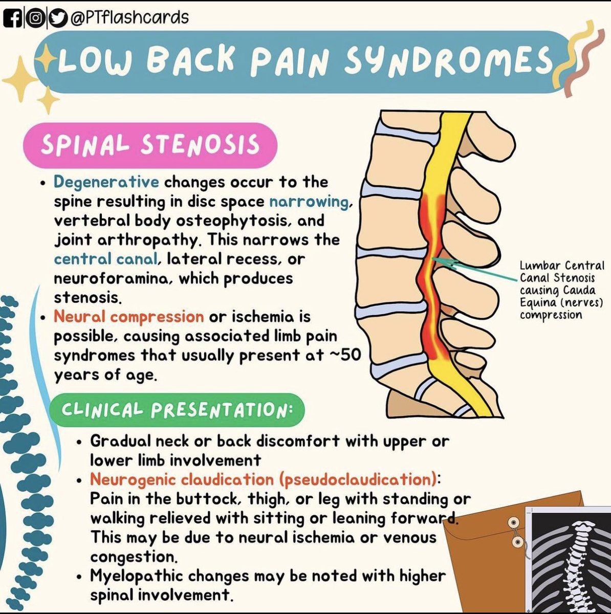 Flashcards

Low Back Pain Differential Diagnosis ✨

Spondylolysis, spondylolisthesis & spinal stenosis 🧐

.