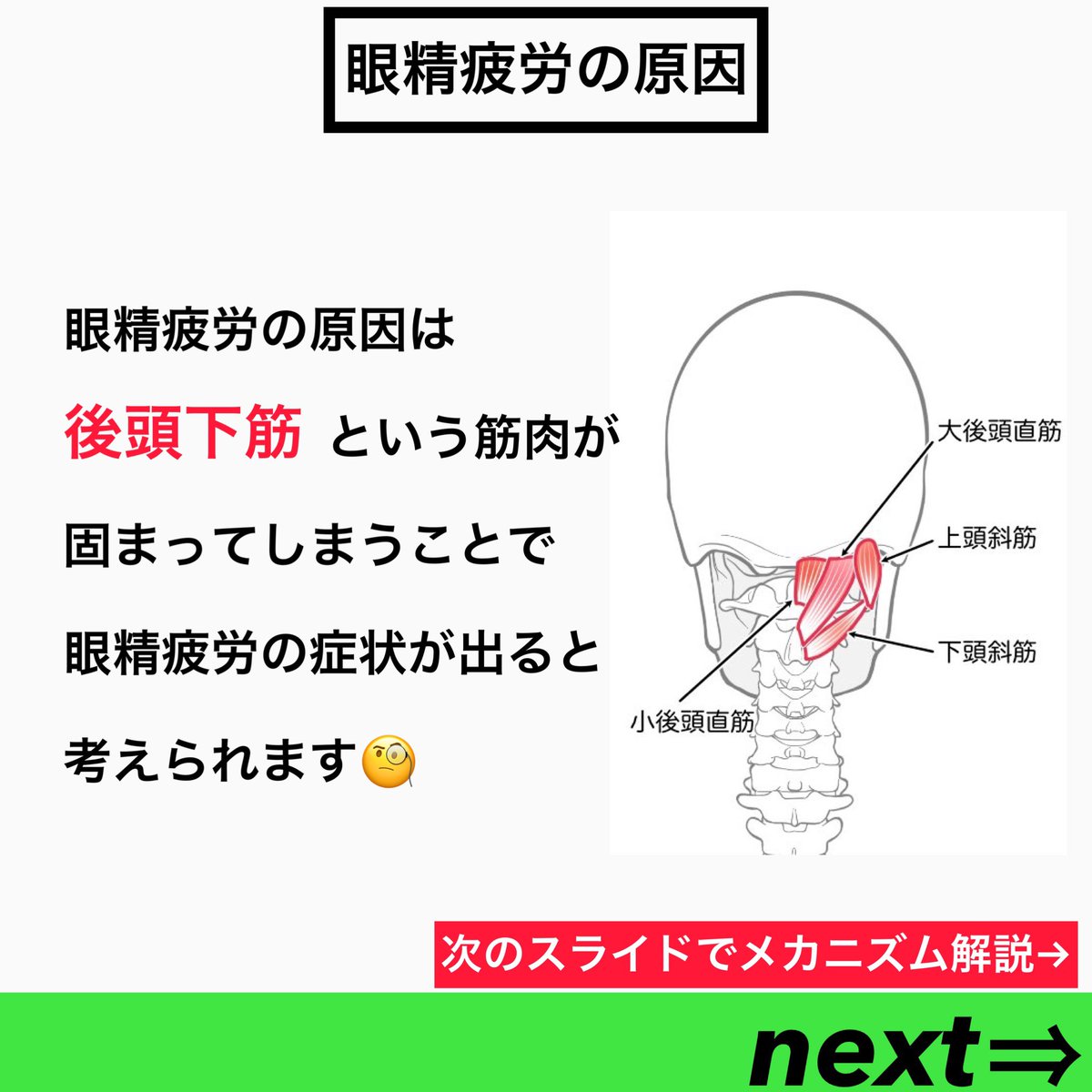 judoOoki's tweet photo. 今回は眼精疲労必見 後頭下筋を緩ませろ
について解説しました！
⁡
~眼精疲労になりやすい人~
⁡
・目を使う作業を続ける
・猫背
・ストレートネック
・長時間のスマホ
・デスクワーク
etc...
⁡
#新座パーソナルトレーニングジム 
#志木パーソナルトレーニングジム 
#朝霞パーソナルトレーニングジム https://t.co/ofO5TXkMse