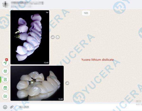 Yuceradental's tweet photo. Feedback from Yucera customers about our glass ceramics!🥳
Thank you for your approval, Yucera is your best choice for dental materials and equipment!🤩
#Yucera #lithiumdisilicate #glassceramic #veneer #inlay #onlay #crown #Aesthetics #restoration #implant #smile #Toothwhitening https://t.co/Jb2M6MV1bI