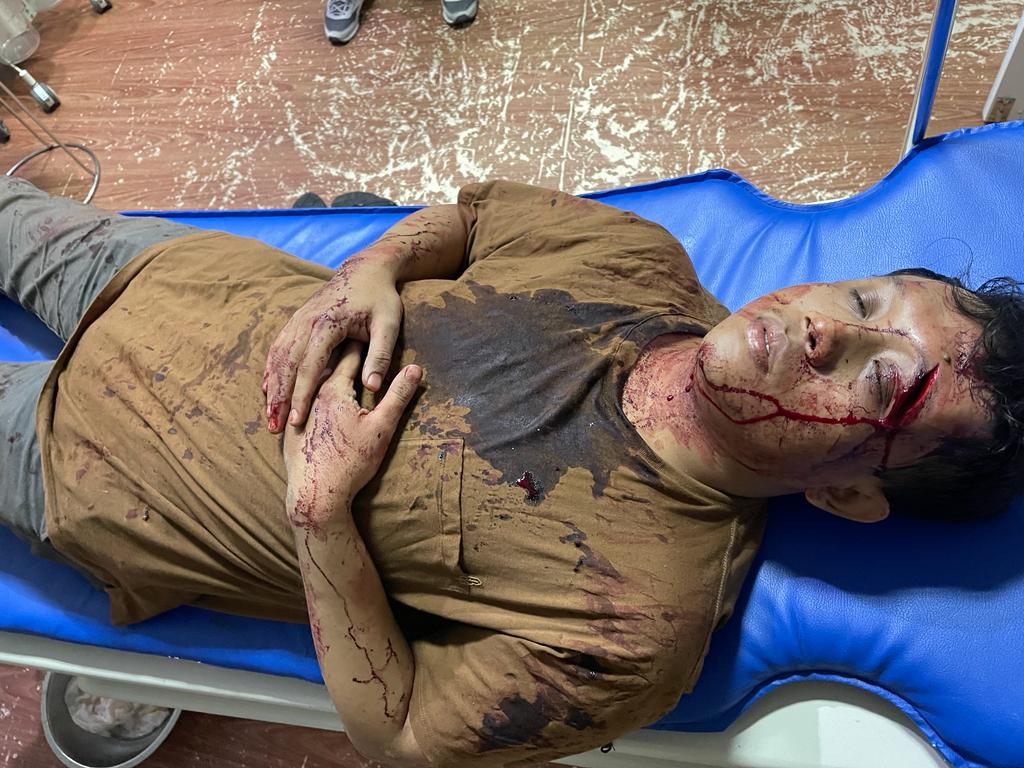 OmKugar's tweet photo. Warga yang menjadi korban penganiyaan sekelompok oknum tentara karena dikiranya polisi,semoga lekas sembuh saudara, dan oknum tentara yang menganiaya CEPAT DI CABUT NYAWANYA OLEH MALAIKAT https://t.co/mf9SLaEur7