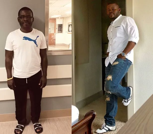 K24Tv's tweet photo. Man undergoes surgery to grow 5 inches taller
https://t.co/D43gW8cNaO https://t.co/Tex7pz9zJE