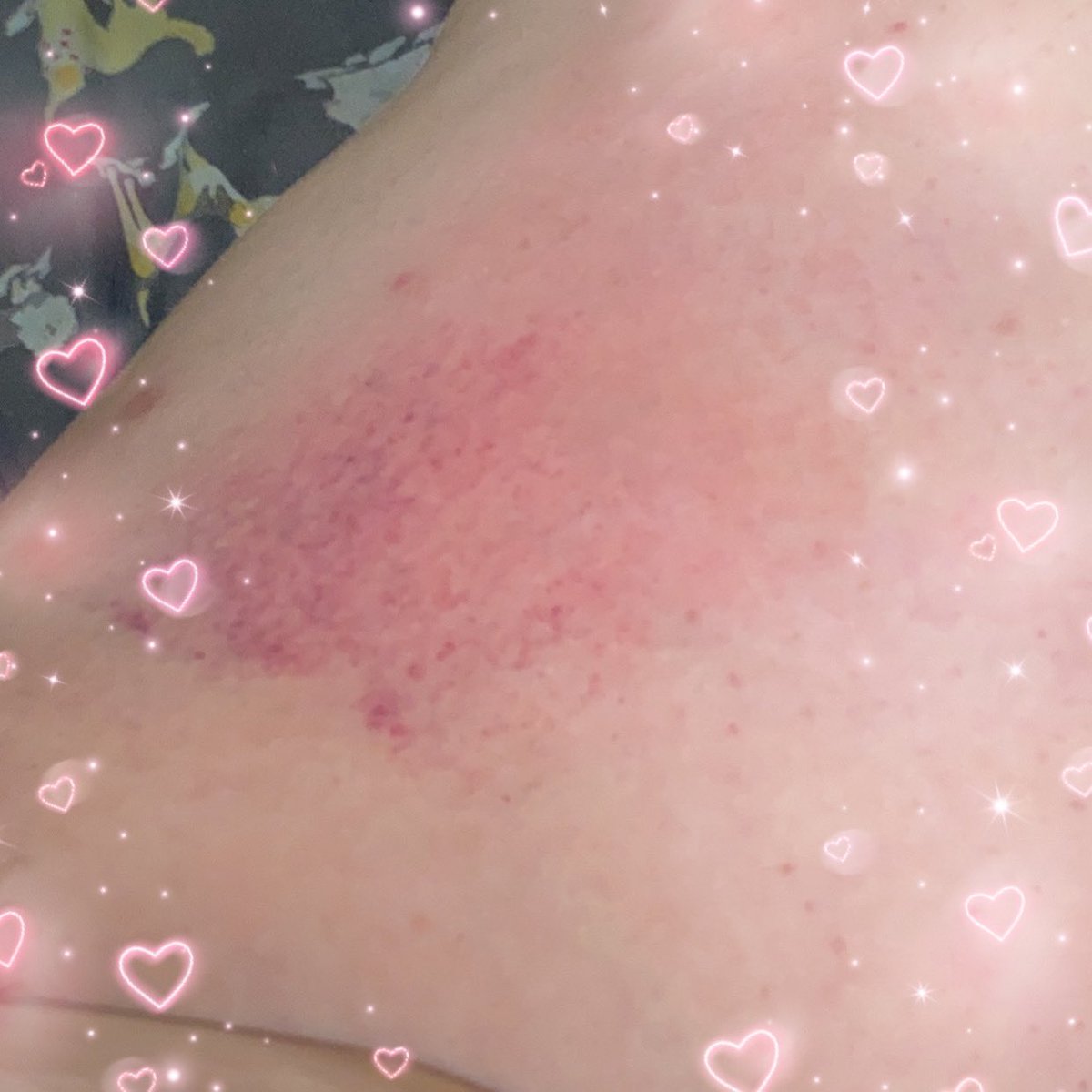 prey_doggy's tweet photo. (He/It)
CW: impact marks
Already starting to see some bruising <3 can’t wait to see it in the morning

#bdsmsub #impactplay #impactmarks #bdsm #nsfwtwt #minorsdni https://t.co/zxnhBiIQJn