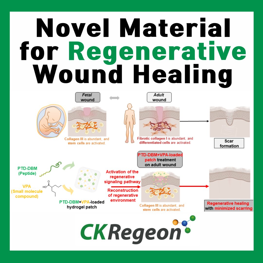 CkRegeon's tweet photo. This is the mechanism of the novel HA-PG adhesive hydrogel patch delivers a combination drug therapy to facilitate regenerative wound healing.

Wound healing and scar reduction of wound therapies can now be achieved by novel regeneration promoting materials. #regenerativewound https://t.co/RL70hgLBWu