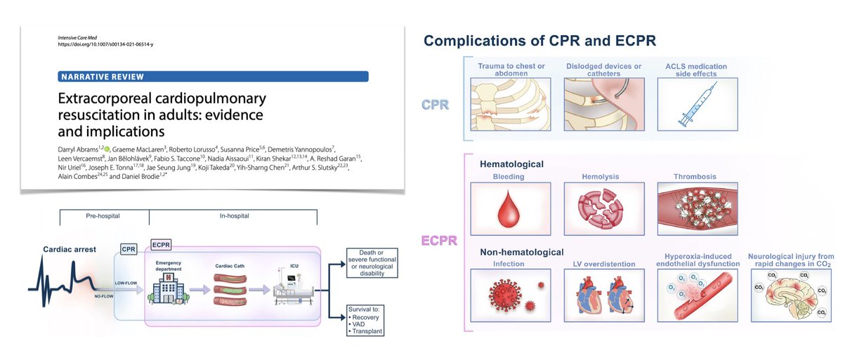 Ultra-early management of pts with CA on #ECPR
🧠 think to brain: sedate! start pre #ECMO, not only for neuroprotection (pt memories?) + be cautious with FdO2 (I/R injury!)
☢️always go to cath lab before moving to #ICU unless evidence for PE (CT first)
<a href="/LionelLamhaut/">Lamhaut</a> #ParisRescue